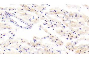 Detection of ITGb8 in Human Cardiac Muscle Tissue using Polyclonal Antibody to Integrin Beta 8 (ITGb8) (ITGB8 抗体  (AA 471-629))