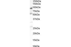 Western Blotting (WB) image for anti-Chitobiosyldiphosphodolichol beta-Mannosyltransferase (ALG1) (C-Term) antibody (ABIN2783688) (ALG1 抗体  (C-Term))