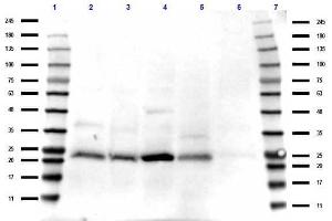 Western Blotting (WB) image for anti-TAF10 RNA Polymerase II, TATA Box Binding Protein (TBP)-Associated Factor, 30kDa (TAF10) (C-Term) antibody (ABIN5706873)