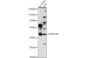 Western blot analysis of extracts of various cell lines, using NFIP antibody (ABIN7268978) at 1:1000 dilution. (NFATC2IP 抗体  (AA 290-360))