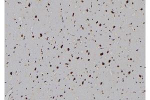 ABIN6276989 at 1/100 staining Human heart tissue by IHC-P. (Phospholipase C beta 1 抗体  (Internal Region))