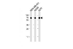 All lanes : Anti-CD63 Antibody (C-term) at 1:2000 dilution Lane 1: MDA-MB-453 whole cell lysate Lane 2:  whole cell lysate Lane 3:  whole cell lysate Lysates/proteins at 20 μg per lane. (CD63 抗体  (C-Term))