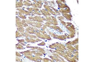 Immunohistochemistry (IHC) image for anti-NADH Dehydrogenase (Ubiquinone) 1 alpha Subcomplex, Assembly Factor 4 (NDUFAF4) (AA 1-170) antibody (ABIN7268807)