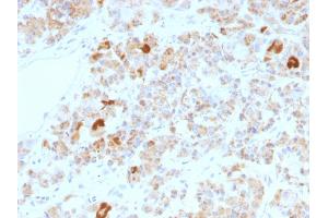 Formalin-fixed, paraffin-embedded human Pituitary stained with LH alpha Mouse Monoclonal Antibody (LHa/756). (CGA 抗体)