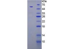 Image no. 3 for Parathyroid Hormone (PTH) (AA 32-115) (Active) protein (MBP tag,His tag) (ABIN5665891) (PTH Protein (AA 32-115) (MBP tag,His tag))