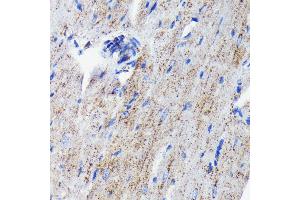 Immunohistochemistry of paraffin-embedded mouse heart using Cathepsin D antibody (ABIN7266149) at dilution of 1:100 (40x lens). (Cathepsin D 抗体)