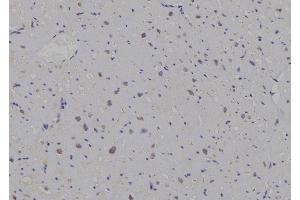 ABIN6259643 and ABIN6269296 at 1/100 staining Human heart tissue by IHC-P. (14-3-3 zeta 抗体  (C-Term))