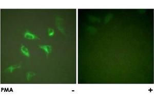 Immunofluorescence analysis of HeLa cells, treated with PMA (125 ng/mL, 30 mins), using YWHAZ polyclonal antibody . (14-3-3 zeta 抗体)