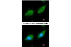 ICC/IF Image Immunofluorescence analysis of methanol-fixed HeLa, using MAP3K8, antibody at 1:200 dilution. (MAP3K8 抗体)