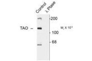 Image no. 1 for anti-TAO Kinase 2 (TAOK2) (pSer181) antibody (ABIN228235)