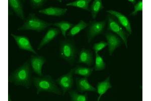 Immunofluorescence analysis of HeLa cells using TREX1 antibody. (TREX1 抗体  (AA 1-270))