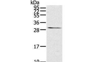 Western Blot analysis of Mouse kidney tissue using TNFSF15 Polyclonal Antibody at dilution of 1:600 (TNFSF15 抗体)
