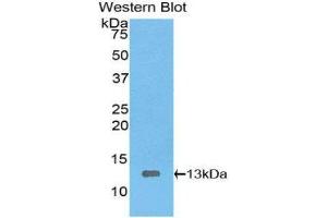 Western Blotting (WB) image for anti-High Mobility Group AT-Hook 1 (HMGA1) (AA 1-107) antibody (ABIN1078144) (HMGA1 抗体  (AA 1-107))