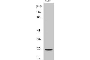 Western Blotting (WB) image for anti-Integrin Alpha7 LC (Cleaved-Glu959) antibody (ABIN5956401) (Integrin Alpha7 LC (Cleaved-Glu959) 抗体)