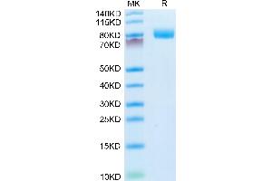 MME Protein (AA 52-750) (His tag)