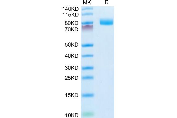 MME Protein (AA 52-750) (His tag)