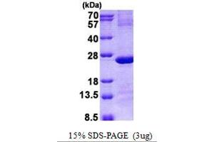 Image no. 1 for IMP3, U3 Small Nucleolar Ribonucleoprotein (IMP3) protein (His tag) (ABIN1098752) (IMP3 Protein (His tag))