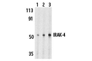 Western Blotting (WB) image for anti-Interleukin-1 Receptor-Associated Kinase 4 (IRAK4) (C-Term) antibody (ABIN1030445)
