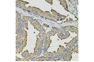 Immunohistochemistry of paraffin-embedded human prostate using SMN2 antibody. (SMN2 抗体  (AA 1-197))