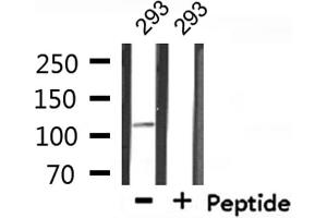 Western blot analysis of extracts from 293, using MED24 Antibody. (MED24 抗体  (C-Term))