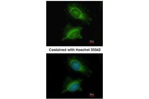 ICC/IF Image Immunofluorescence analysis of methanol-fixed HeLa, using PGM3, antibody at 1:200 dilution. (Phosphoglucomutase 3 抗体)