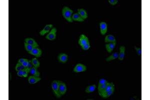 Immunofluorescence staining of HepG2 cells with ABIN7153343 at 1:266, counter-stained with DAPI. (GPR39 抗体  (AA 345-453))