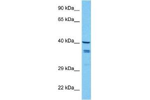 Host:  Mouse  Target Name:  WNT7B  Sample Tissue:  Mouse Spleen  Antibody Dilution:  1ug/ml (WNT7B 抗体  (Middle Region))