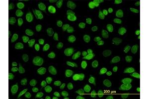Immunofluorescence of monoclonal antibody to EMD on HeLa cell. (Emerin 抗体  (AA 1-110))