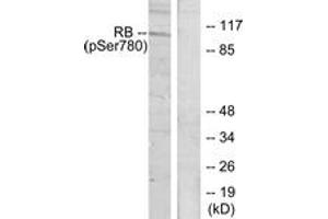 Western blot analysis of extracts from K562 cells treated with serum 10%, using Retinoblastoma (Phospho-Ser780) Antibody. (Retinoblastoma Protein (Rb) 抗体  (pSer780))