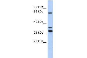 WB Suggested Anti-S100PBP Antibody Titration: 0. (S100PBP 抗体  (Middle Region))