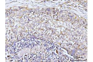 IHC analysis of GIT1 using anti-GIT1 antibody (ABIN7601683). (GIT1 抗体  (AA 415-736))