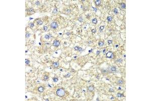 Immunohistochemistry (Paraffin-embedded Sections) (IHC (p)) image for anti-ATP Synthase, H+ Transporting, Mitochondrial F1 Complex, alpha Subunit 1, Cardiac Muscle (ATP5A1) antibody (ABIN6137324)
