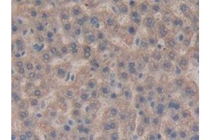 Detection of CTGF in Rat Liver Tissue using Monoclonal Antibody to Connective Tissue Growth Factor (CTGF) (CTGF 抗体  (AA 25-347))
