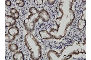 Immunoperoxidase of monoclonal antibody to CHFR on formalin-fixed paraffin-embedded human small Intestine. (CHFR 抗体  (AA 1-652))