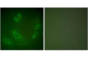 Immunofluorescence analysis of HeLa cells, using HSP105 Antibody. (HSPH1 抗体  (AA 791-840))