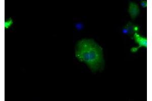 Image no. 2 for anti-Sorting Nexin 9 (SNX9) antibody (ABIN1501047) (SNX9 抗体)
