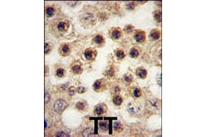 Formalin-fixed and paraffin-embedded human testis tissue reacted with YBX2 polyclonal antibody  , which was peroxidase-conjugated to the secondary antibody, followed by DAB staining. (YBX2 抗体  (C-Term))