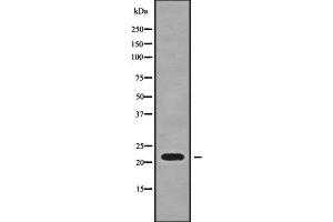 Western blot analysis SFT2D3 using HT-29 whole cell lysates (SFT2D3 抗体  (N-Term))