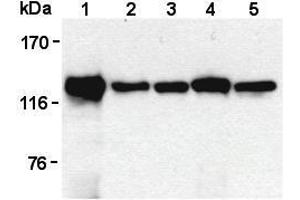 Western Blotting (WB) image for anti-Signal-Induced Proliferation-Associated 1 (SIPA1) antibody (ABIN1449259) (SIPA1 抗体)