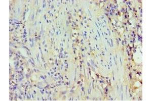 Immunohistochemistry of paraffin-embedded human epityphlon tissue using ABIN7173805 at dilution of 1:100 (BAFF 抗体  (AA 76-285))