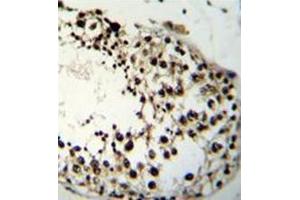 Immunohistochemistry analysis in formalin fixed and paraffin embedded human testis tissue reacted with LIN28A Antibody (Center) followed which was peroxidase conjugated to the secondary antibody and followed by DAB staining. (LIN28A 抗体  (Middle Region))