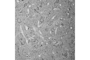 Immunohistochemistry (IHC) image for anti-Ras Homolog Gene Family, Member A (RHOA) (AA 100-150) antibody (ABIN351037)
