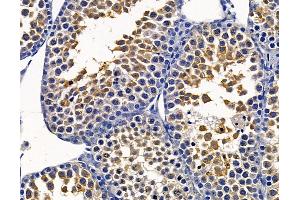ABIN7095059 and ABIN7099115 at 1/100 staining mouse testis tissue by IHC-P. (TMEM126A 抗体)