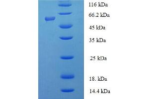 SDS-PAGE (SDS) image for Inositol Polyphosphate-5-Phosphatase, 40kDa (INPP5A) (AA 1-409), (full length) protein (His-SUMO Tag) (ABIN5711313)