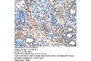 Human kidney (SLC7A14 抗体  (N-Term))