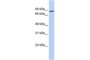 WB Suggested Anti-AR Antibody Titration: 0. (Androgen Receptor 抗体  (N-Term))