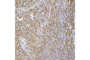 Immunohistochemistry of paraffin-embedded human tonsil using RPL13 Rabbit mAb (ABIN7269993) at dilution of 1:50 (40x lens). (RPL13 抗体)