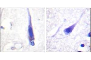 Immunohistochemistry analysis of paraffin-embedded human brain tissue, using Calmodulin (Ab-79/81) Antibody. (Calmodulin 1 抗体  (AA 46-95))