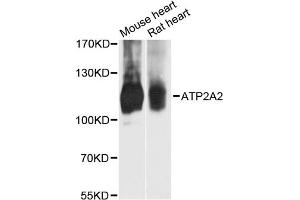Western blot analysis of extracts of various cell lines, using ATP2A2 antibody. (ATP2A2 抗体)