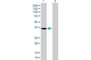 Western Blot analysis of XPA expression in transfected 293T cell line by XPA MaxPab polyclonal antibody. (XPA 抗体  (AA 1-273))
